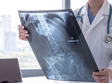 179521-Common-radiology-tests-explained 179521-Common-radiology-tests-explained
